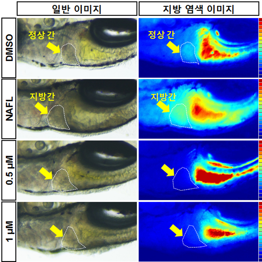 ‘오토파지’ 조절 간경변 치료제 후보물질 기술이전 이미지