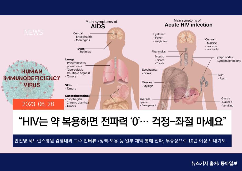 [동아일보] “HIV는 약 복용하면 전파력 ‘0’ ... 걱정-좌절 마세요” 이미지