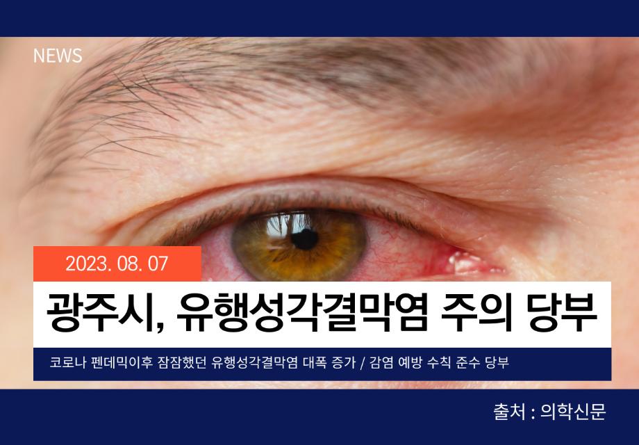 [의학신문] 광주시, 유행성각결막염 주의 당부 이미지