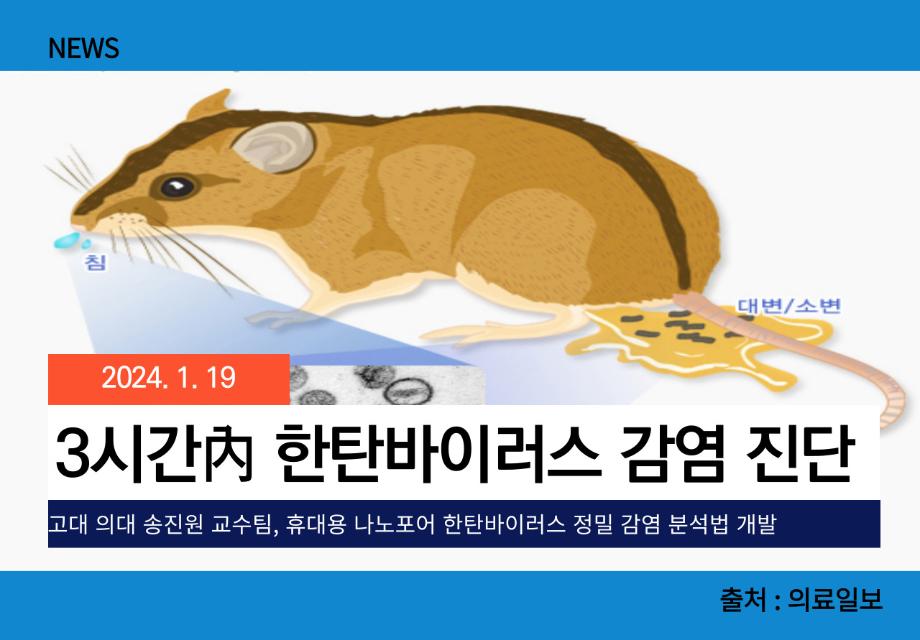 [의료일보] 3시간內 한탄바이러스 감염 진단 이미지