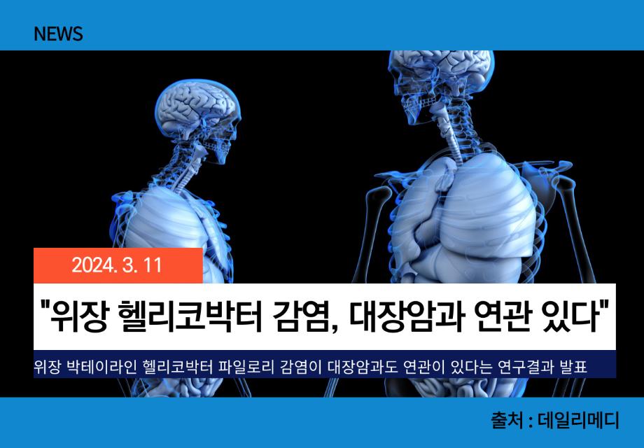 [데일리메디] "위장 헬리코박터 감염, 대장암과 연관 있다" 이미지