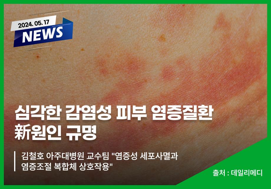 [데일리메디] 심각한 감염성 피부 염증질환  新원인 규명 이미지