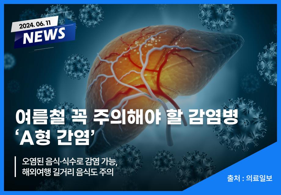 [의료일보] 여름철 꼭 주의해야 할 감염병 ‘A형 간염’ 이미지