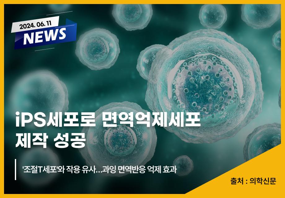 [의학신문] iPS세포로 면역억제세포 제작 성공 이미지