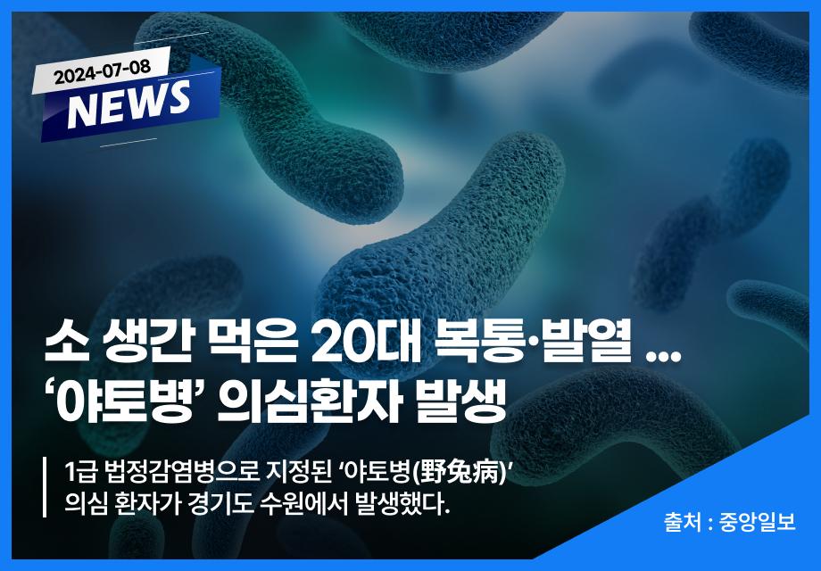 [중앙일보] 소 생간 먹은 20대 복통·발열 ... ‘야토병’ 의심환자 발생 이미지