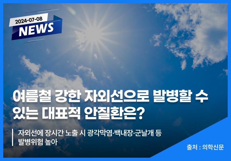 [의학신문] 여름철 강한 자외선으로 발병할 수 있는 대표적 안질환은? 이미지