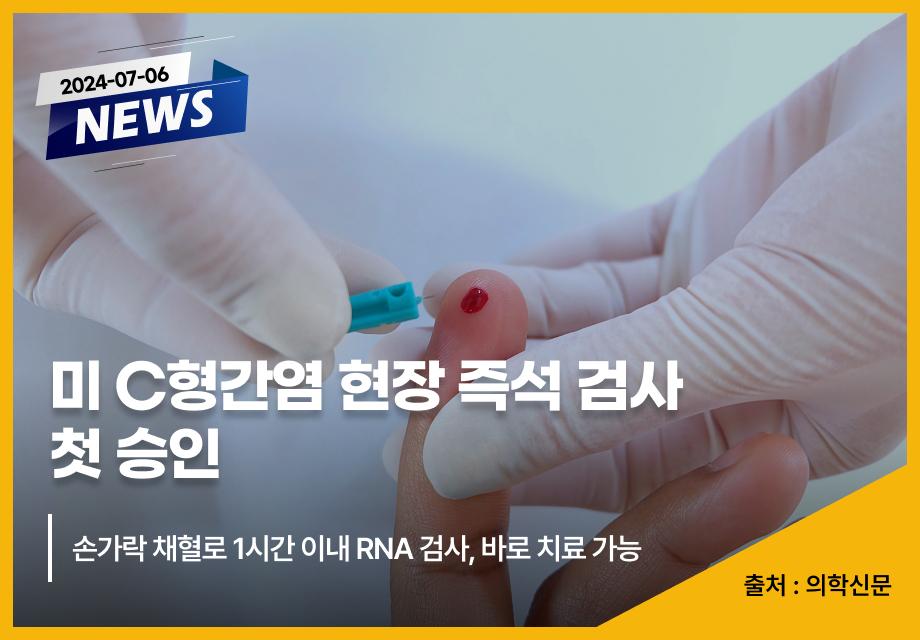 [의학신문] 미 C형간염 현장 즉석 검사 첫 승인 이미지